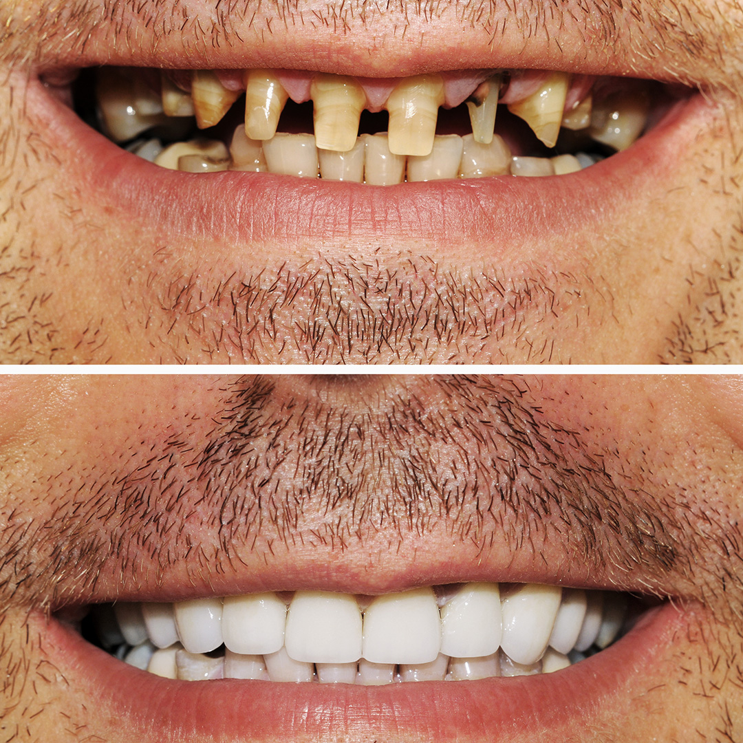 askew-dental-dentist by dr malikjpg